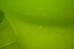 M0010157