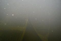 M0010160